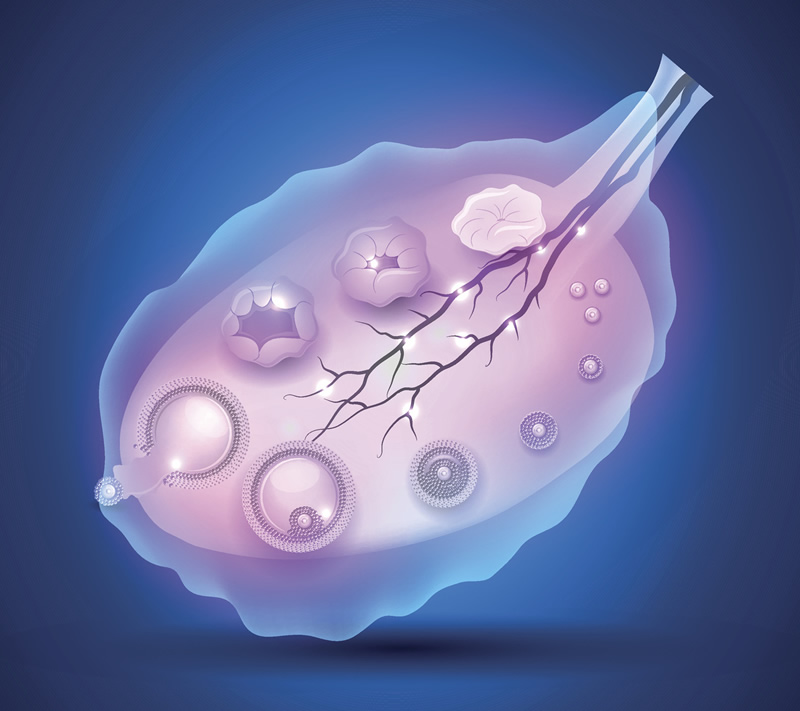 双侧输精管缺如做试管婴儿的概率大吗？